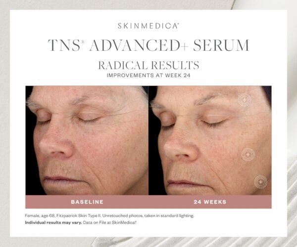 SkinMedica TNS® Advanced+ Essential Serum - Image 3